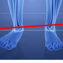 AlivioMax™ - Dê um fim nas dores nos pés em poucos dias